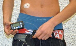 microinfusore_pancreas_296